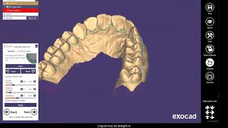 Design a bite splint for 3d printing in Exocad [upl. by Aihsat]