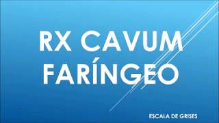 RADIOGRAFIA DE CAVUM FARINGEO [upl. by Amme]