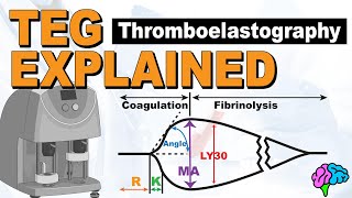 TEG Explained  Understanding the Thromboelastography [upl. by Lorenz]