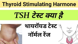 TSH Test in Hindi  Thyroid Stimulating Harmone  tsh report in hindi [upl. by Sahcnip349]