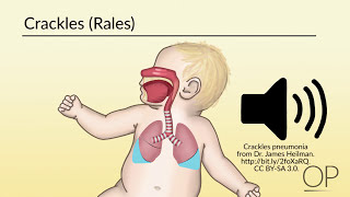 Respiratory Assessment by B Leary L DelSignore  OPENPediatrics [upl. by Vaules]