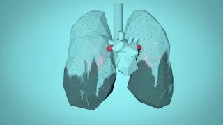 WHO Breathe Life  How air pollution impacts your body [upl. by Dallon]