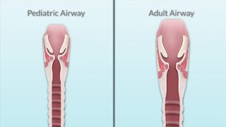 Pediatric Airway Assessment by T Miller  OPENPediatrics [upl. by Cullie]