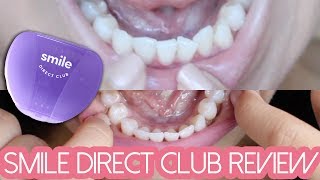 SMILE DIRECT CLUB REVIEW Final Thoughts [upl. by Hamrah]