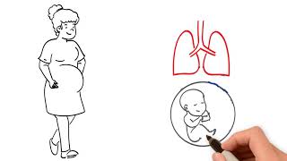 Cardiovascular Changes in Pregnancy [upl. by Tildie]