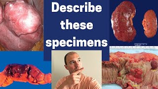 How to describe gross pathology specimens [upl. by Schwinn413]