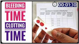 BT CT Test  Bleeding Time AND Clotting Time Coagulation Time Blood Test [upl. by Phaidra]