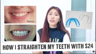 How I straighten my teeth with only 24 Really effective [upl. by Einahpats]