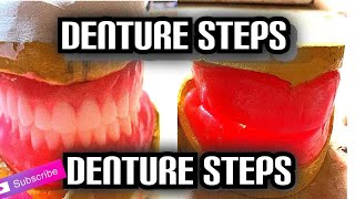 Denture Steps Bite Blocks and Bite Registration [upl. by Asa461]