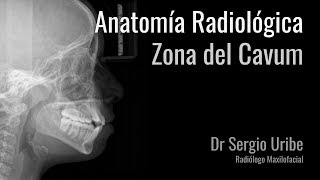 Radiologia Anatomia Cavum [upl. by Kesia]